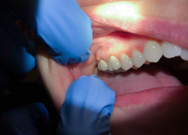 Best Cosmetic Emergency Dentistry in Ogallala, NE